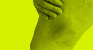 5 sinais na pele que podem indicar problemas de sade